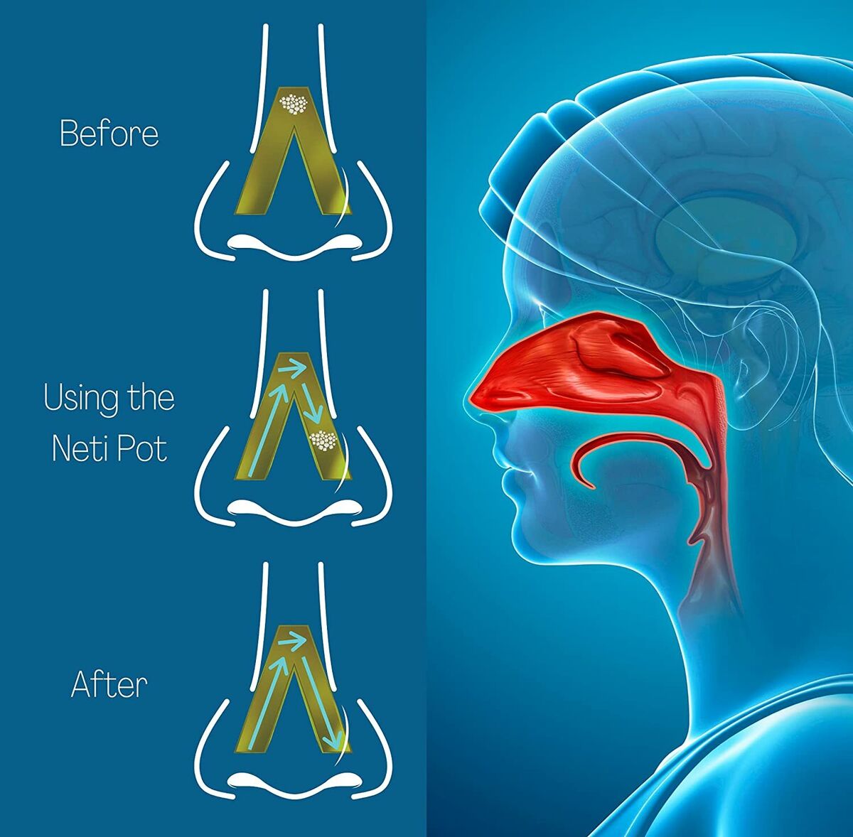 The Power of Breath: Rediscovering the Neti Pot